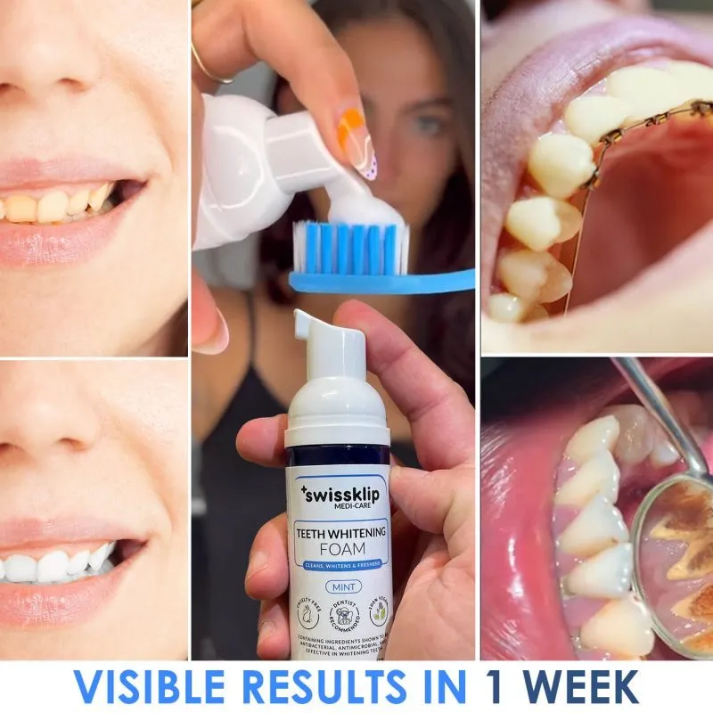 29652 teeth whitening routine