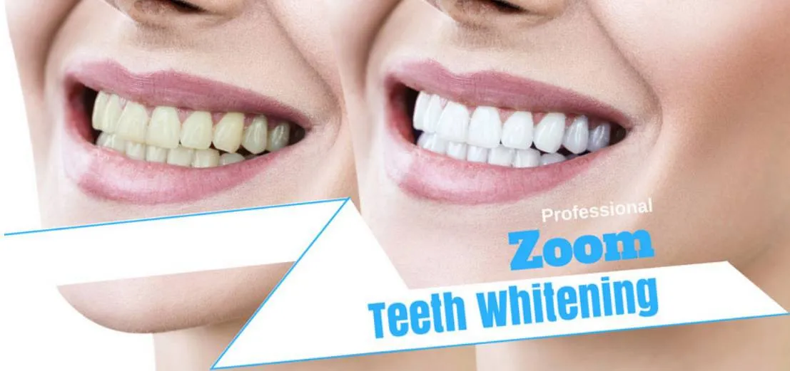 29655 britesmile whitening process