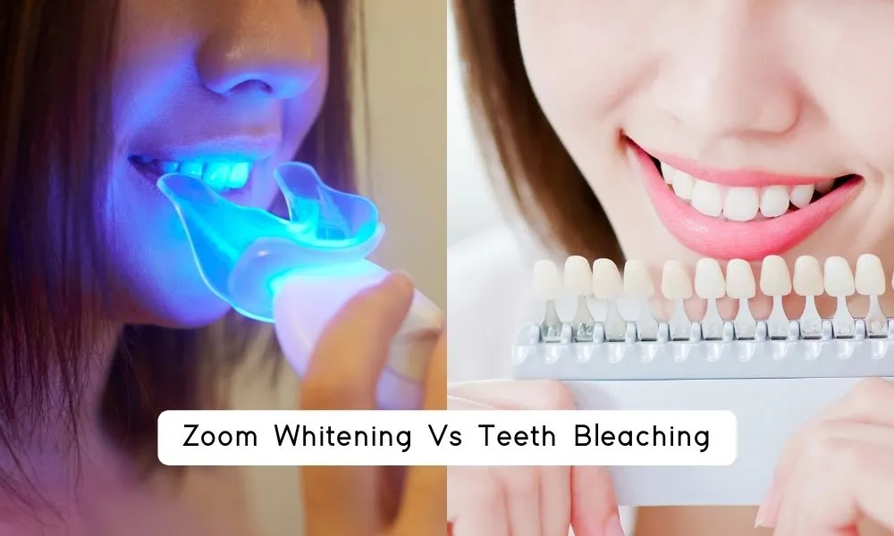 29655 teeth whitening results