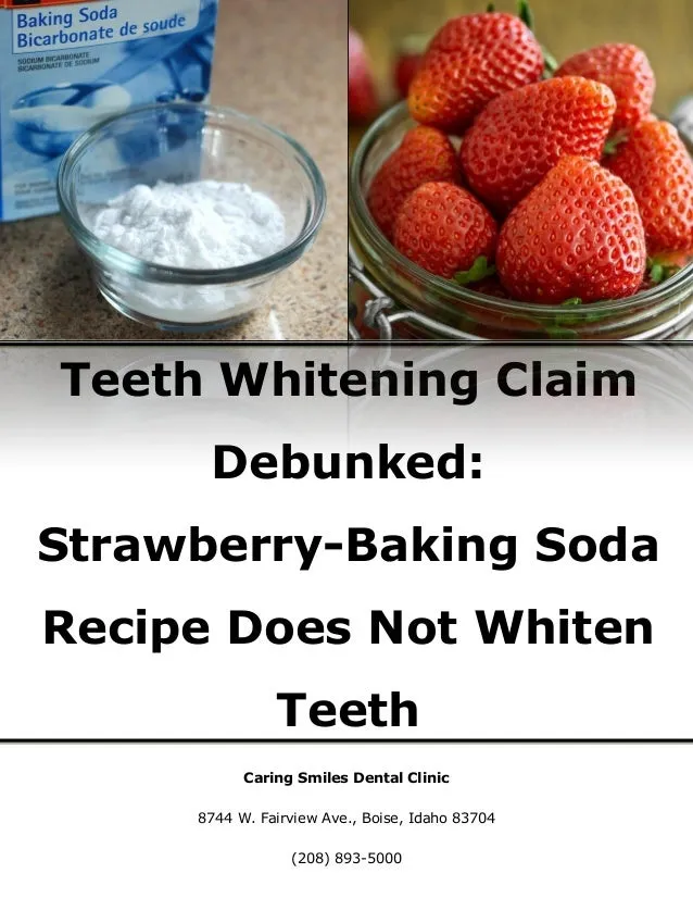 29656 apply teeth whitening