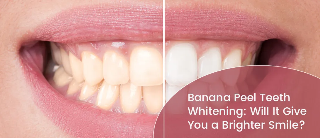 29665 banana peel teeth whitening 3