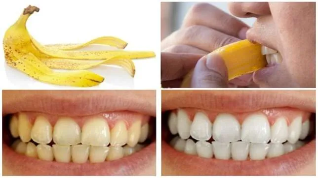 29665 banana peel teeth whitening 4