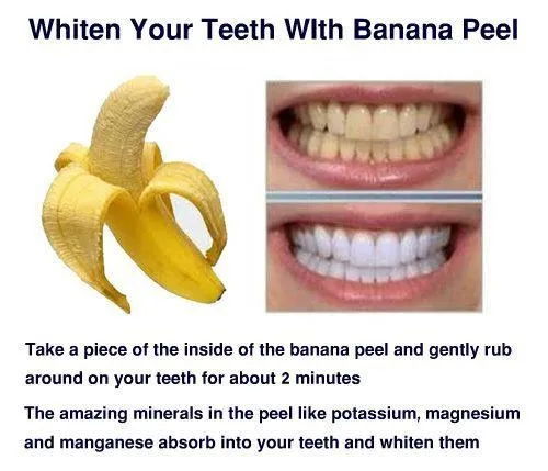 29665 banana peel teeth whitening 5