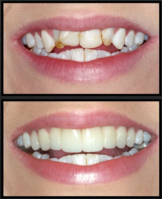 29666 whitening toothpaste