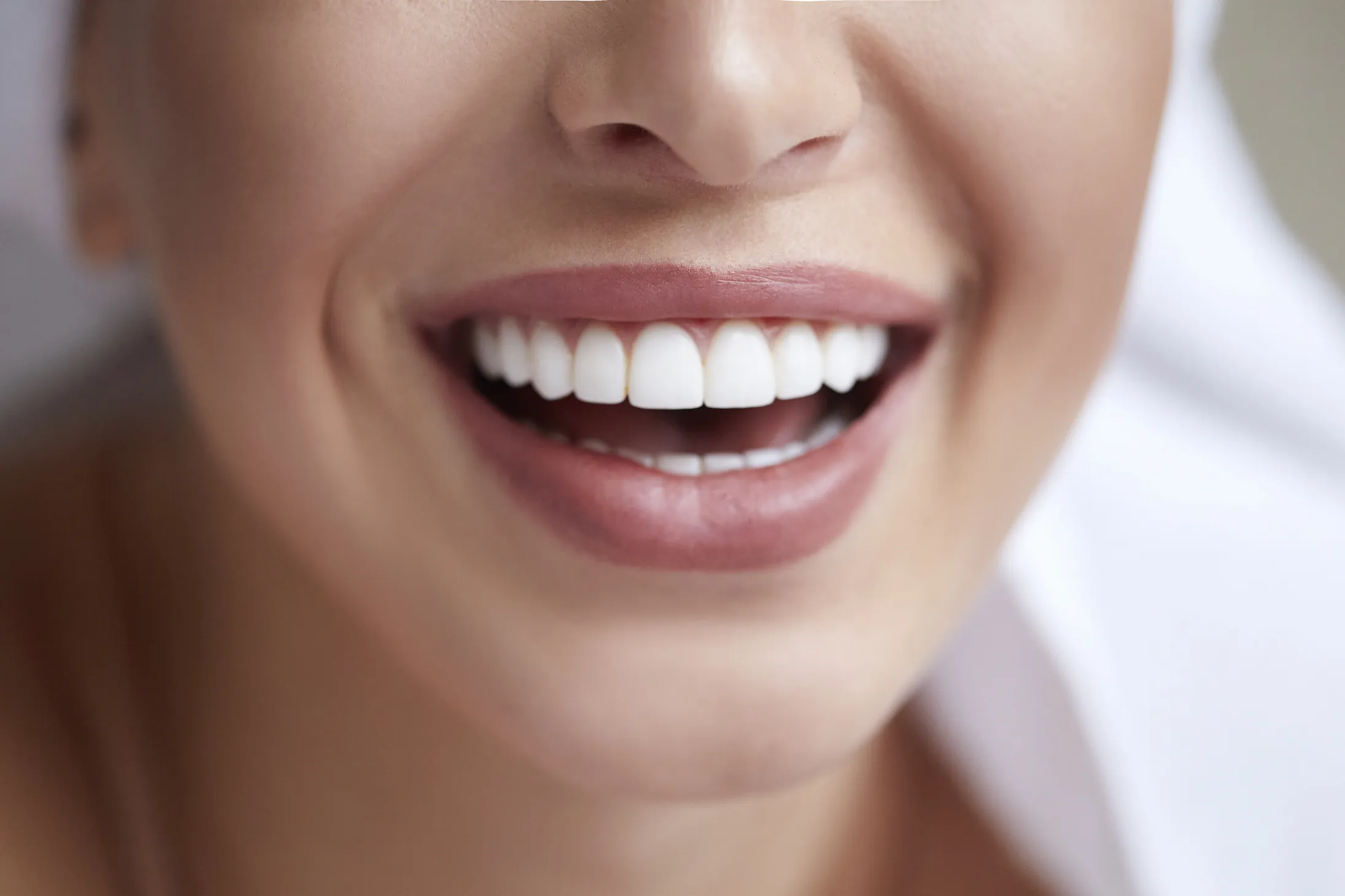 29670 over the counter teeth whitening
