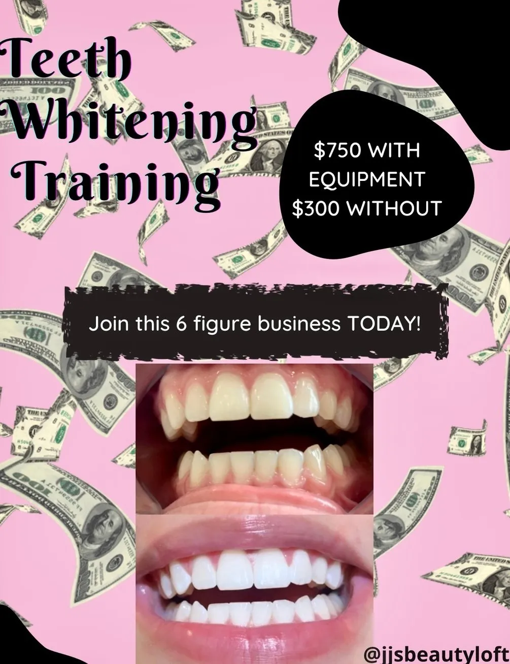 29678 teeth whitening specialist