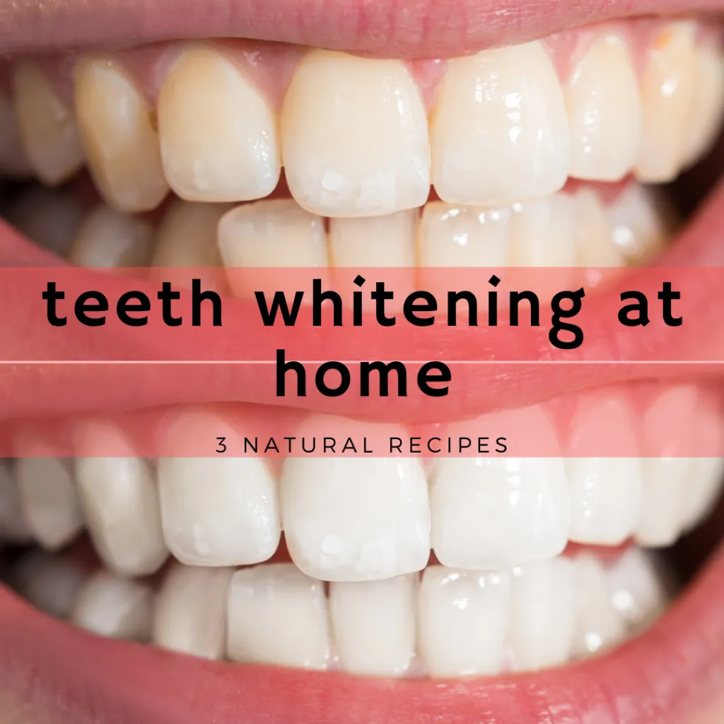 29685 teeth whitening brushing