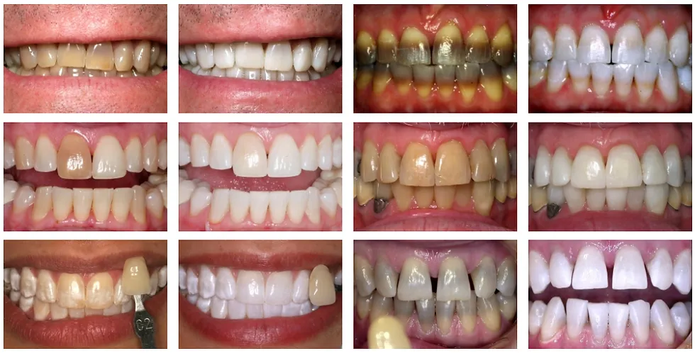 29691 healthy smile