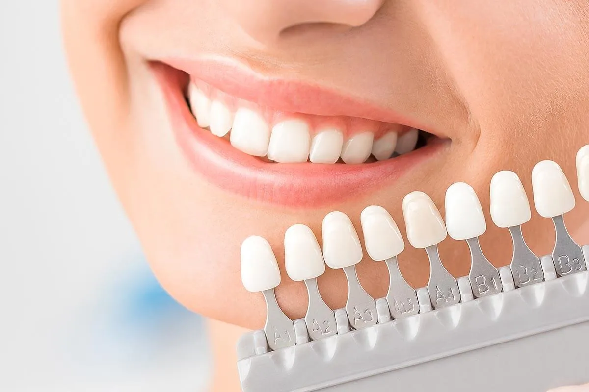 29700 teeth whitening diet recommendations