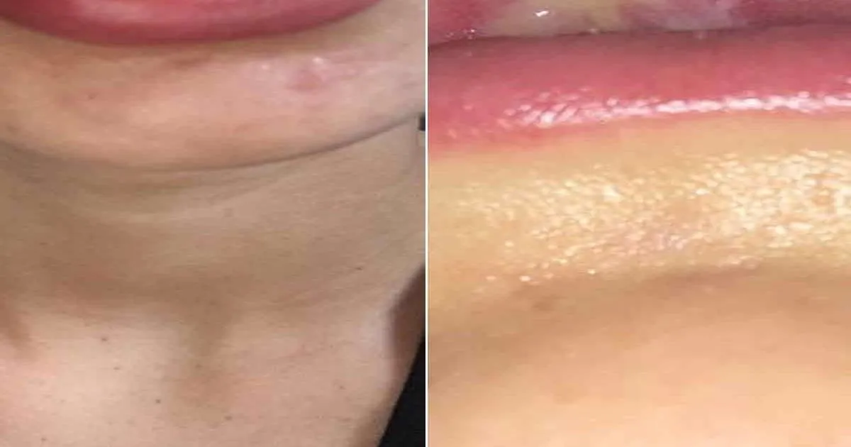 29703 professional teeth whitening