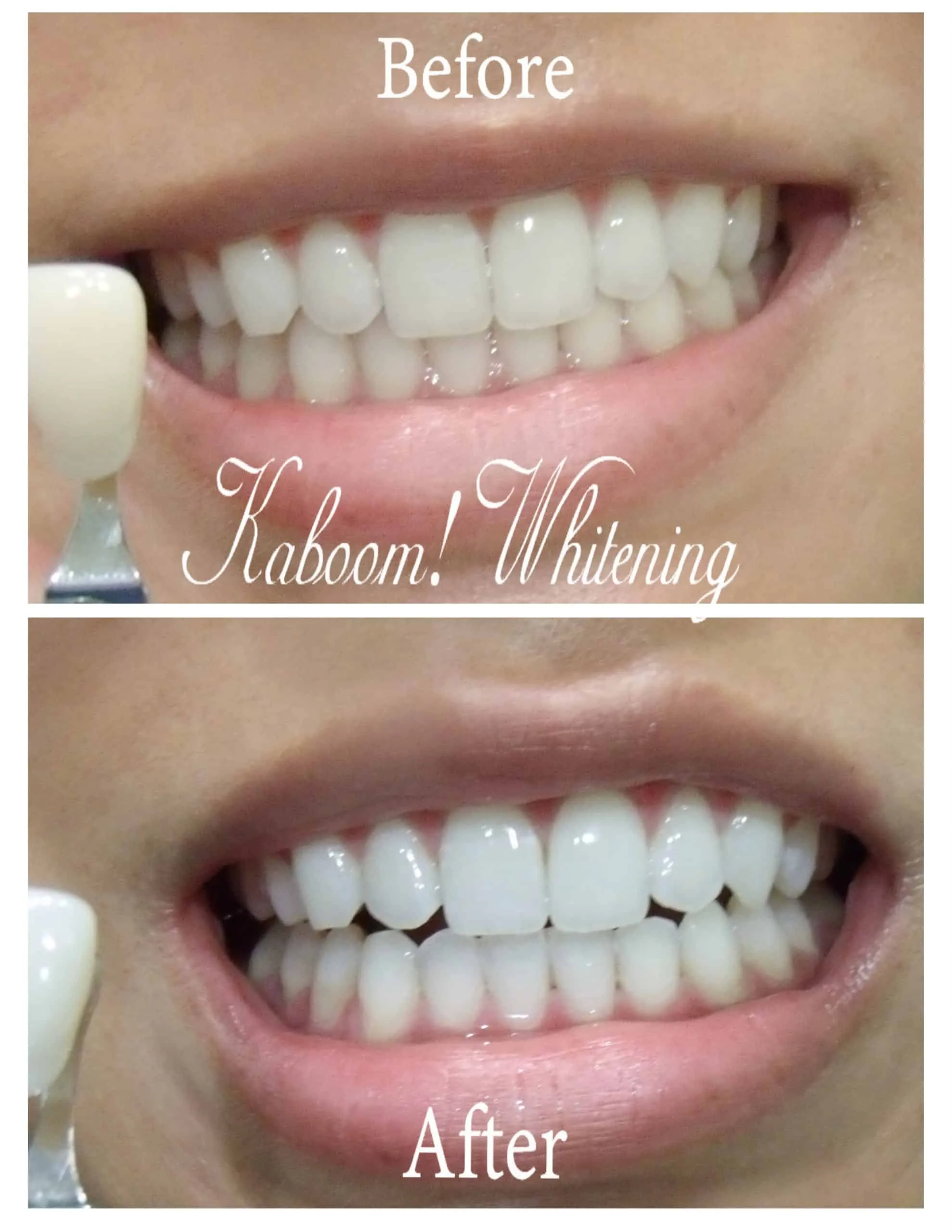 /img/29707-maintaining-white-teeth.webp