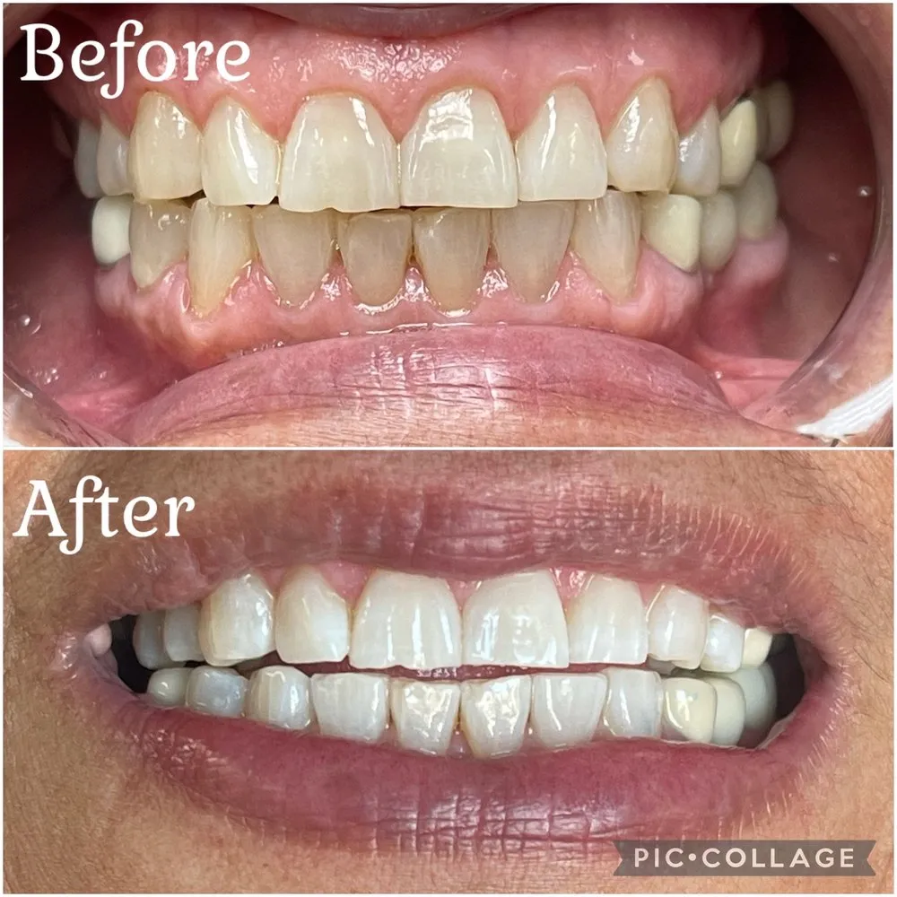 29708 stained teeth causes
