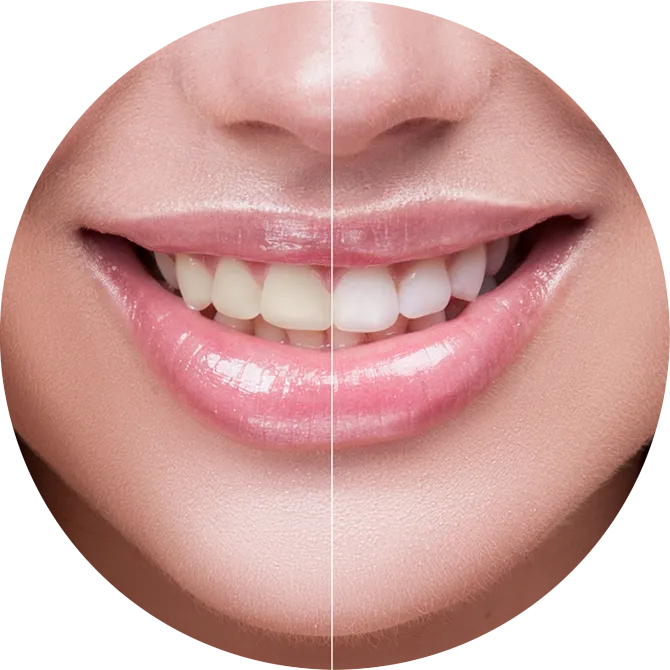 29712 studio city teeth whitening before after