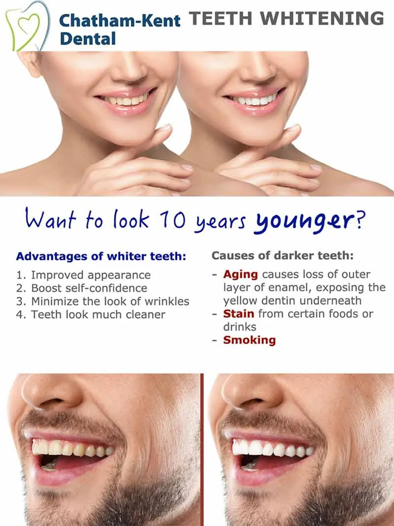 29716 tooth whitening kent image6