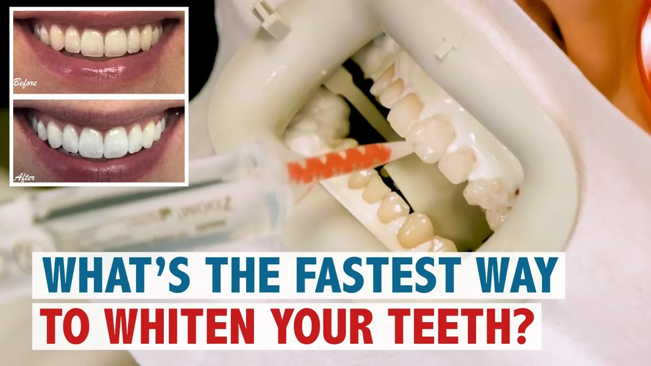 29719 healthy diet teeth