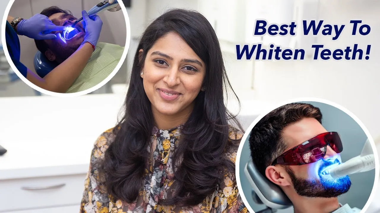29719 professional teeth whitening