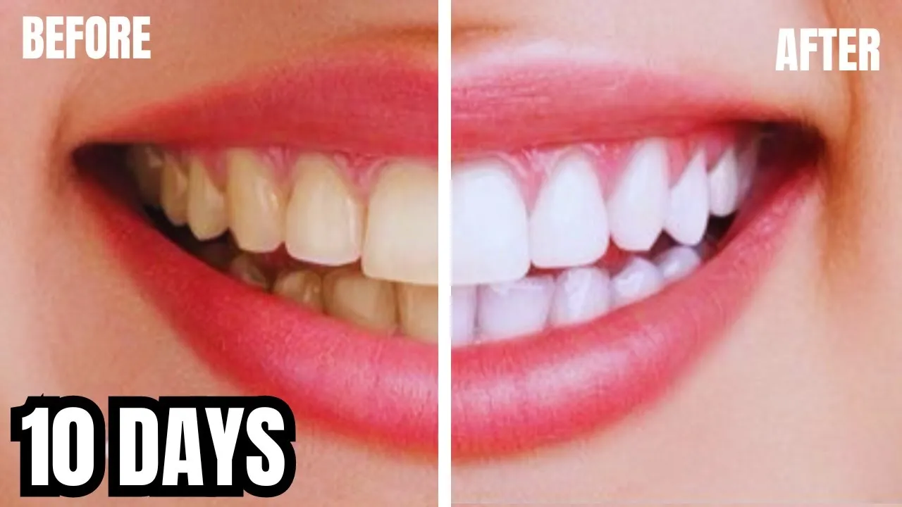 29719 teeth whitening smile