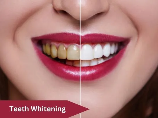 29719 whitening toothpaste