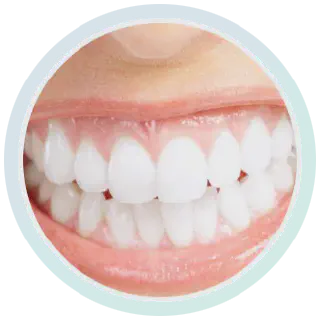 /img/29723-teeth-whitening-coquitlam-bc-image7.webp