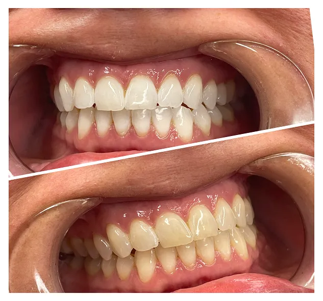 29724 dental checkup