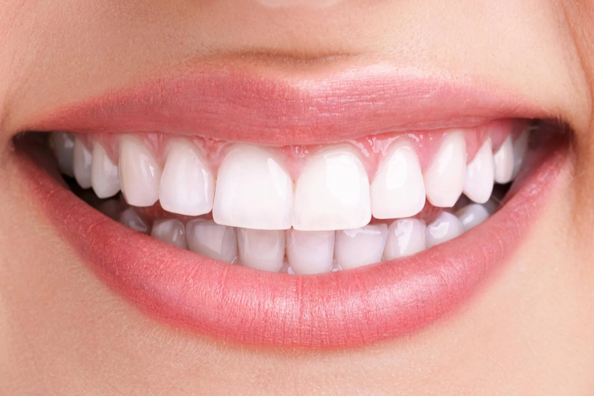 29724 vancouver teeth whitening