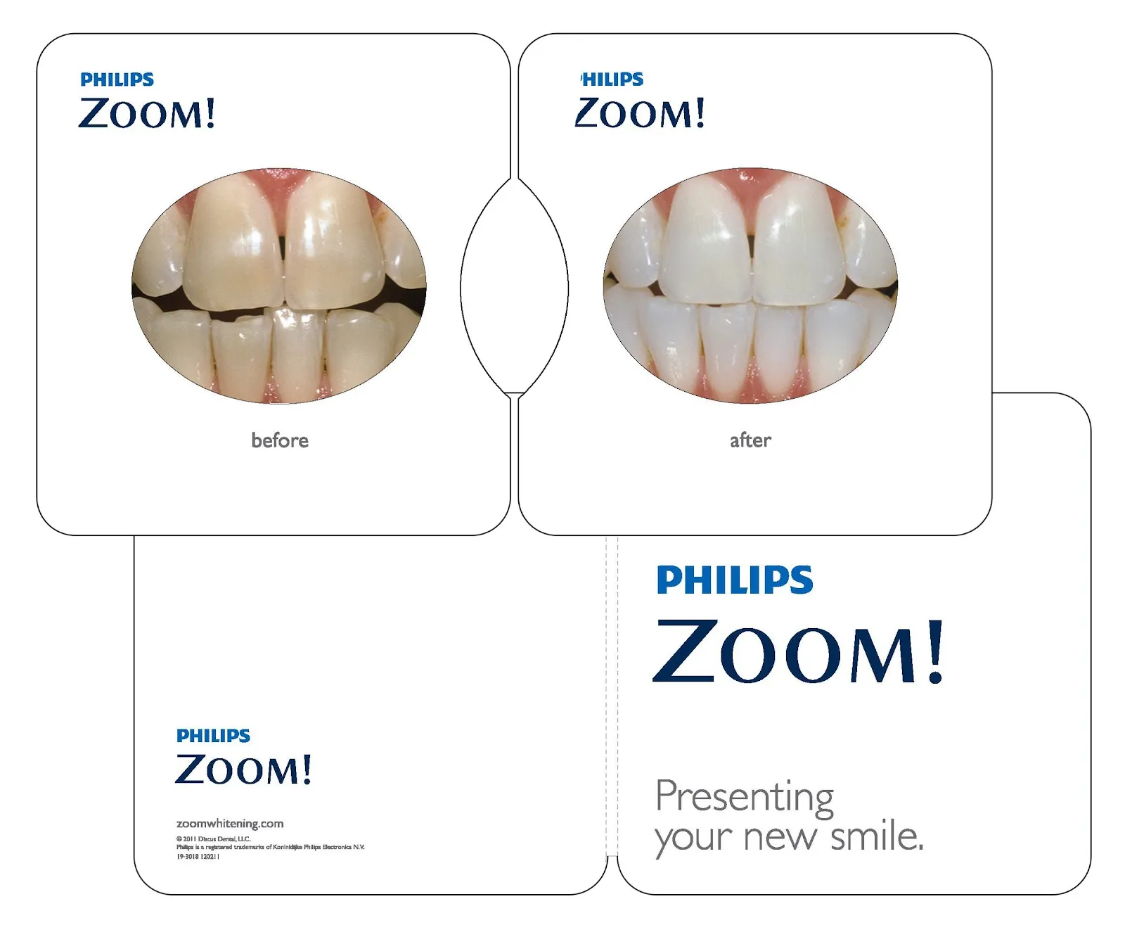 29726 philips zoom whitening sensitivity 6
