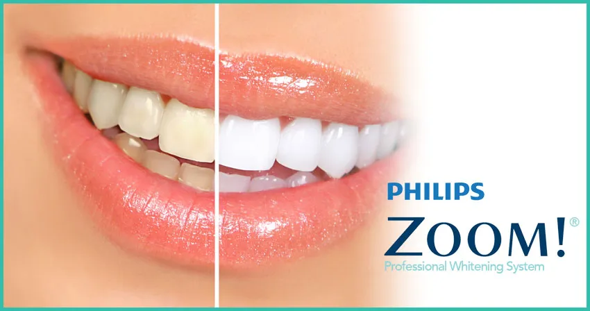 /img/29726-philips-zoom-whitening-sensitivity-7.webp