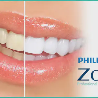 /img/29726-philips-zoom-whitening-sensitivity-7.webp