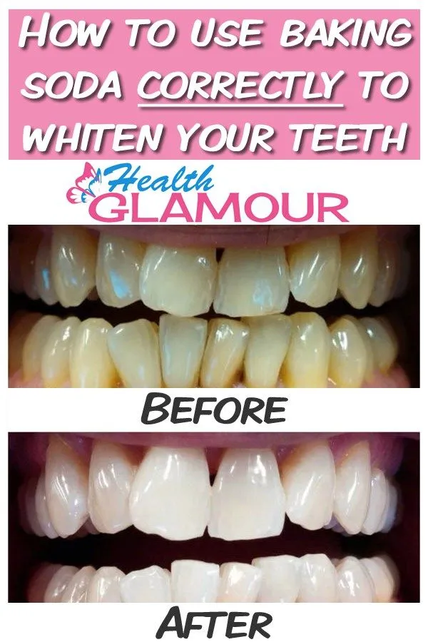 29730 whitening products