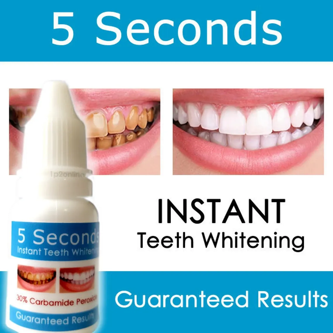 29735 instant teeth whitening itw at home kits