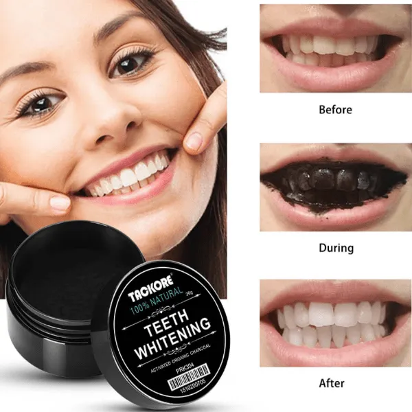 29736 teeth whitening alternatives