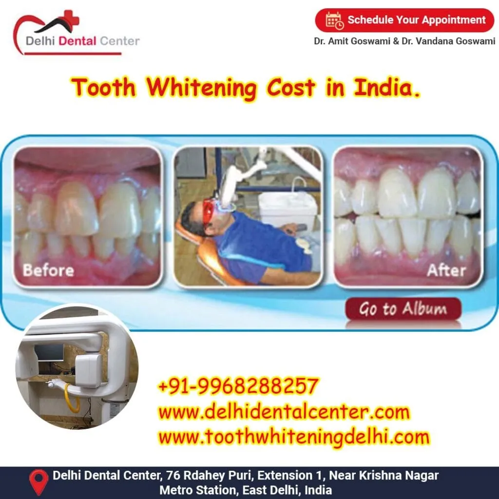 29740 dental clinic india