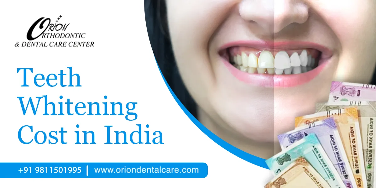 29740 teeth whitening procedure