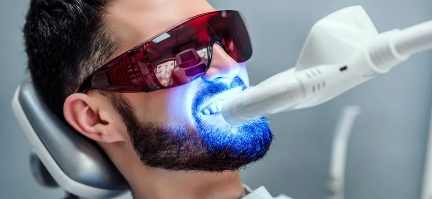 29746 boulder teeth whitening overview