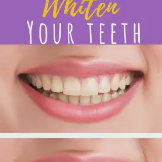 /img/29747-teeth-whitening-instructions.webp