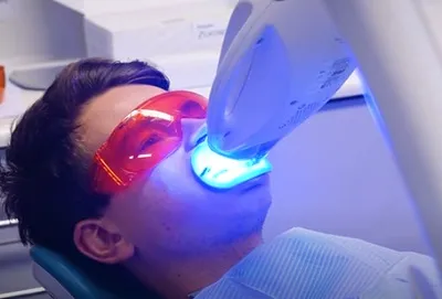 29752 bupa teeth whitening overview