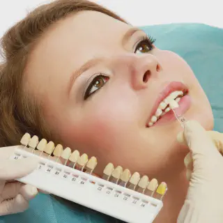 /img/29752-teeth-whitening-budget.webp