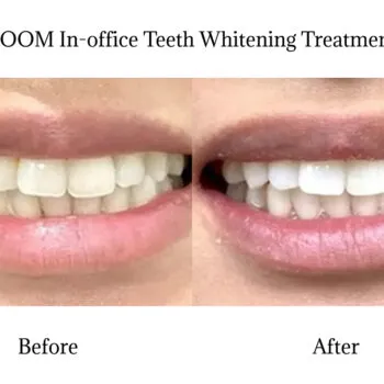 29755 whitening toothpaste