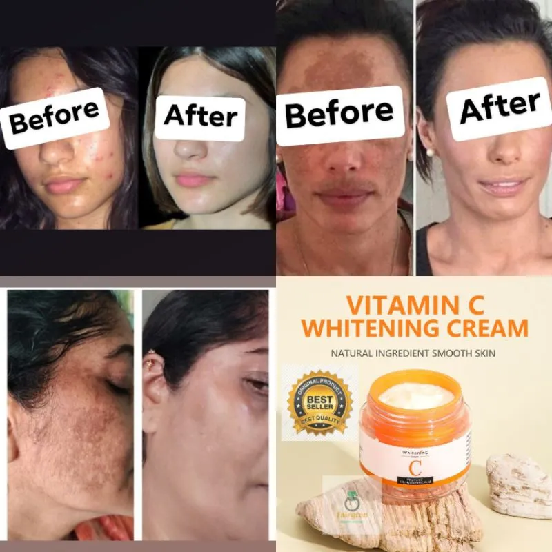 29756 skin tone improvement