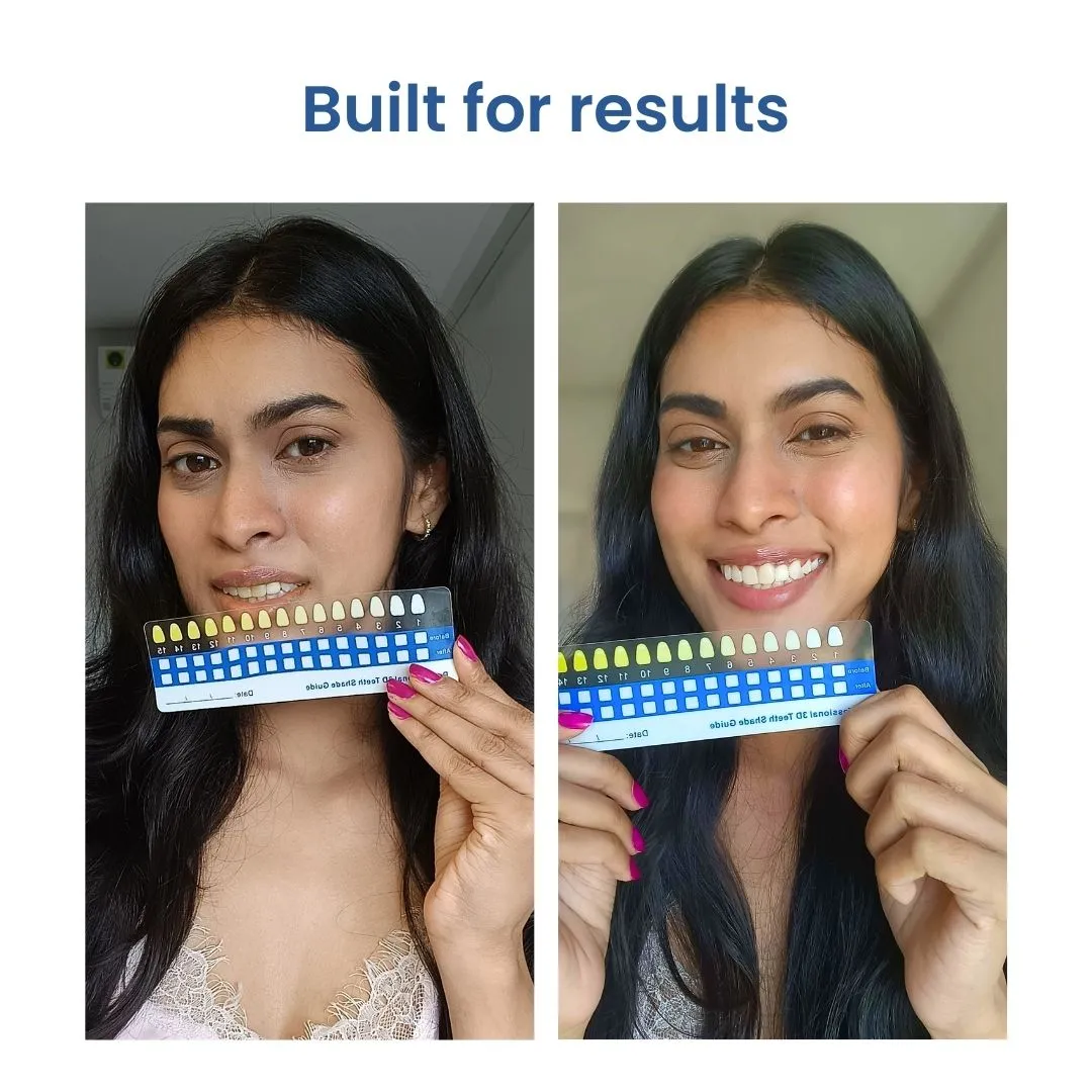 29758 teeth whitening pen portability