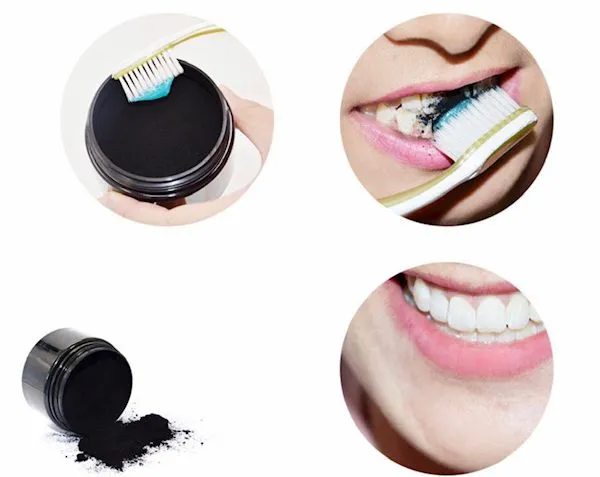 29763 teeth whitening results