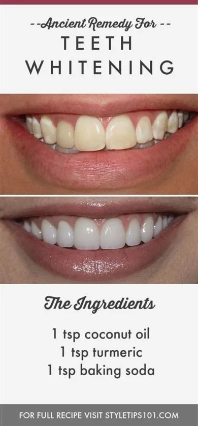 29769 sensitive teeth whitening 4