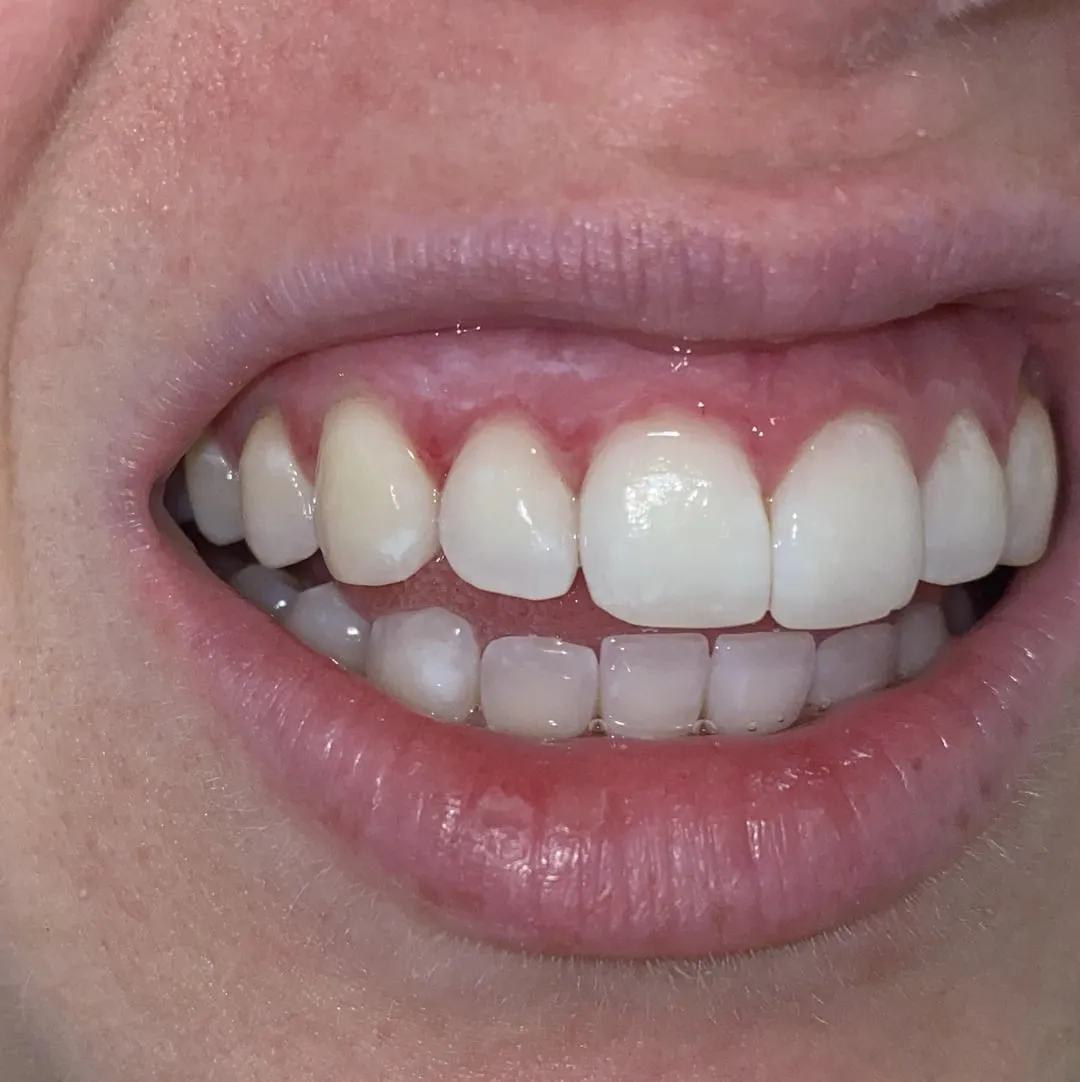 29771 dentist consultation