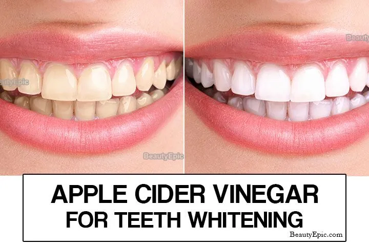 29773 apple cider vinegar ingredients