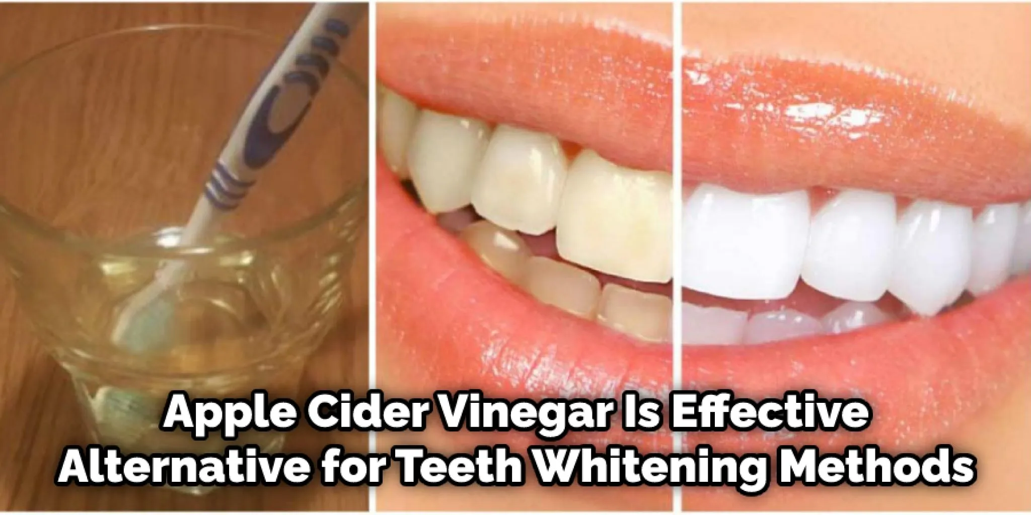 29773 apple cider vinegar teeth before after