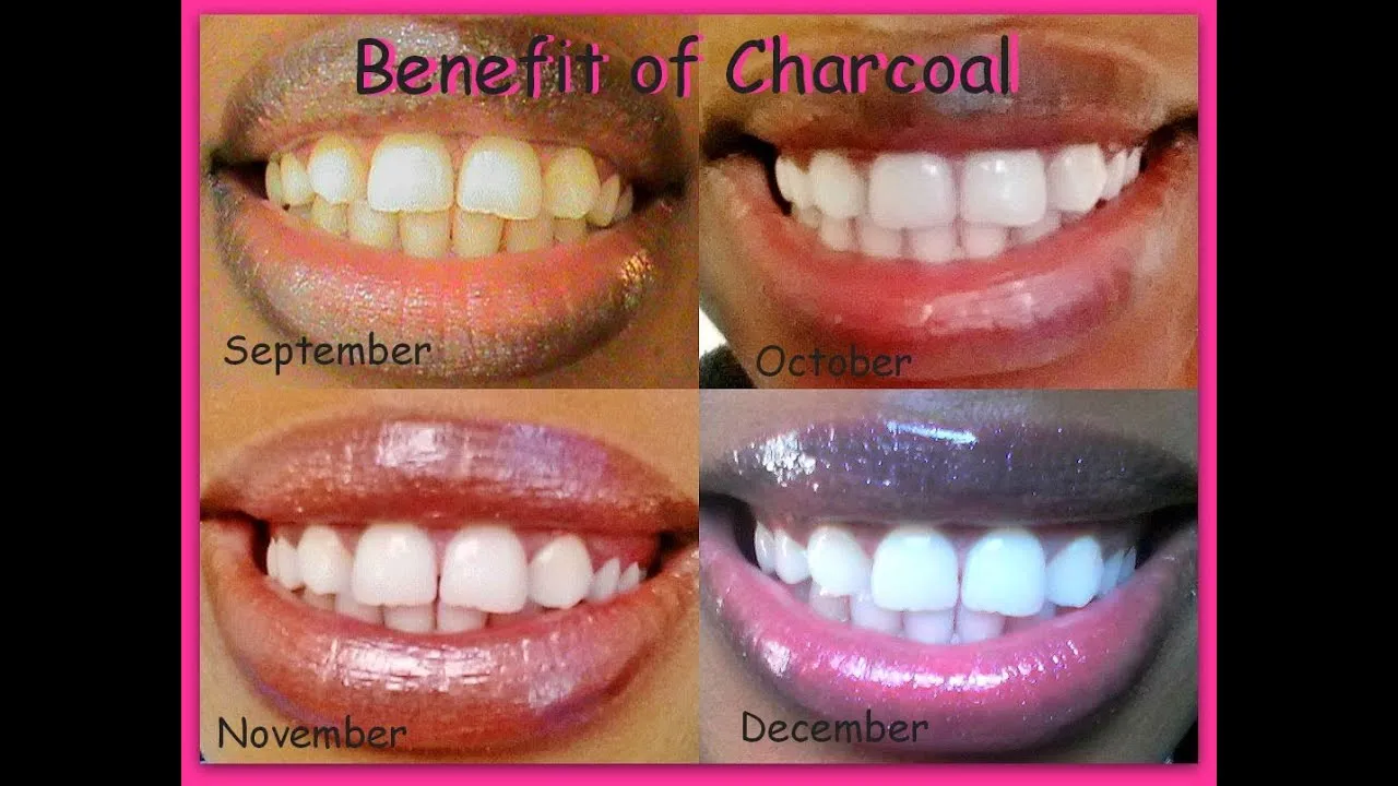 29783 applying charcoal teeth whitening