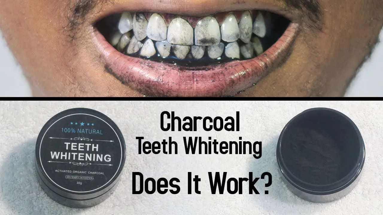 /img/29783-over-the-counter-teeth-whitening.webp