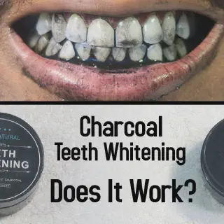 /img/29783-over-the-counter-teeth-whitening.webp