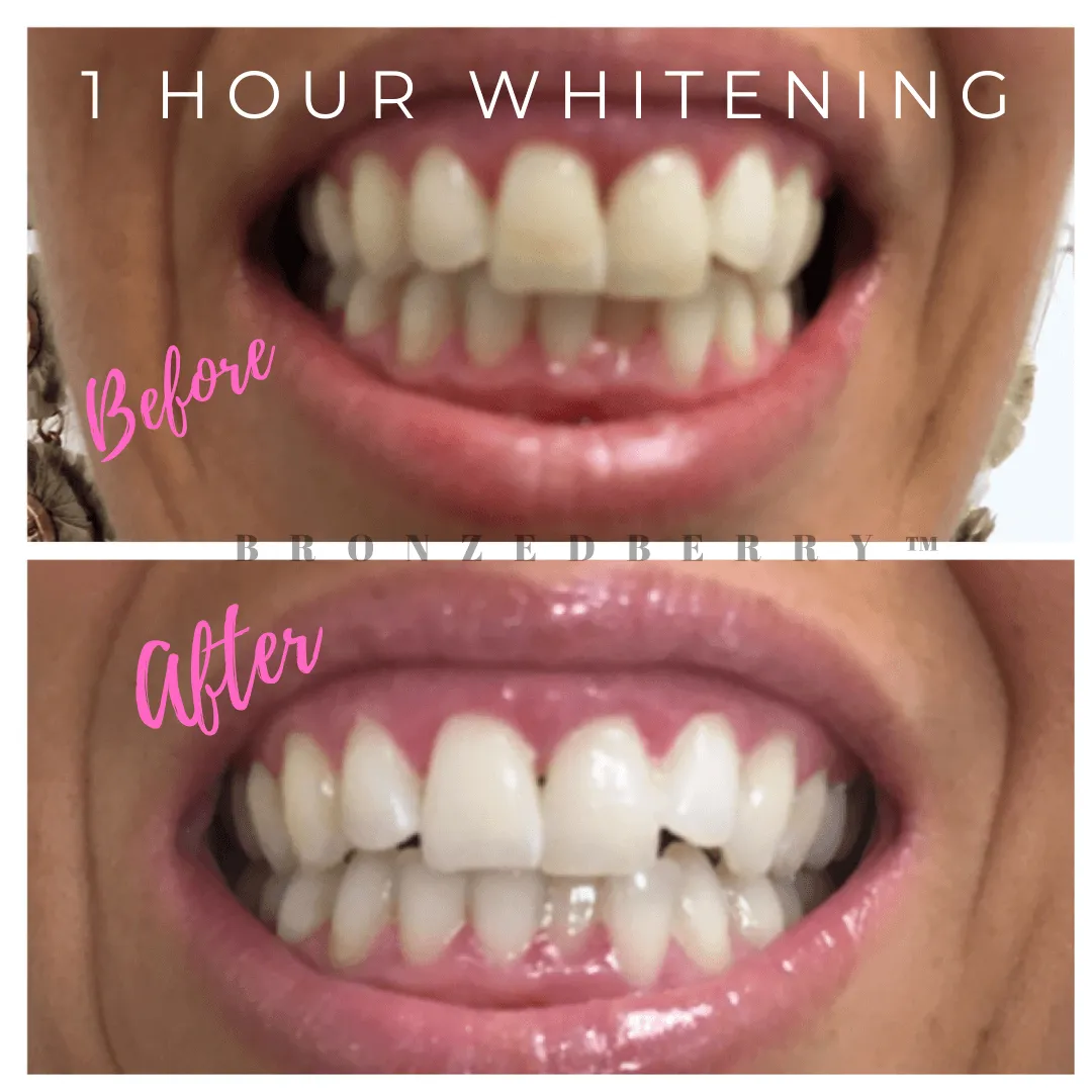 29784 tooth whitening training 6