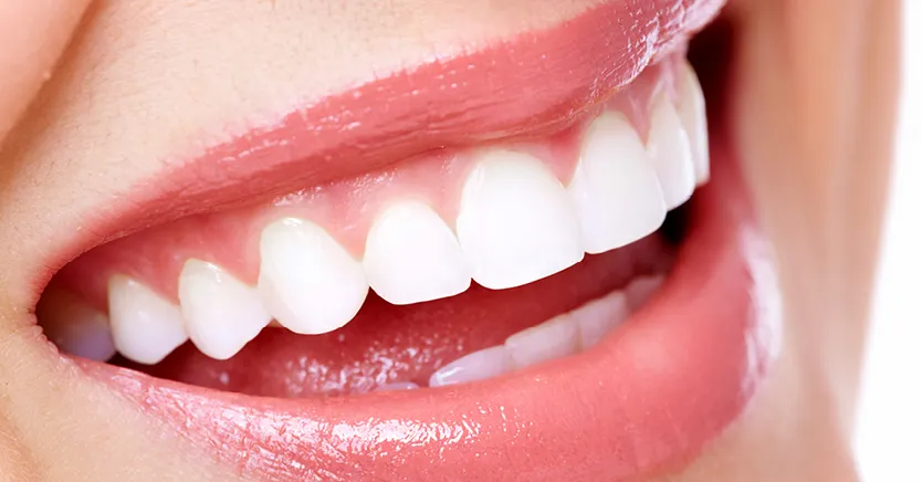 29787 teeth whitening tunisia clinic